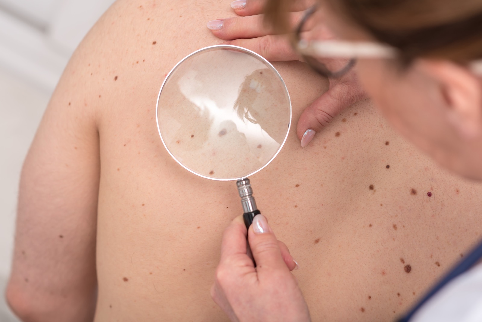 Consultation at Bloomfield Laser Clinic