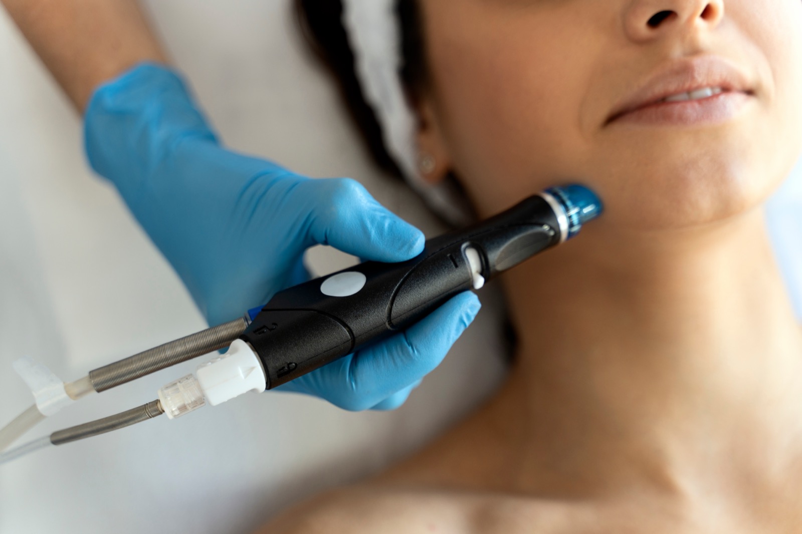 Microdermabrasion facial treatment