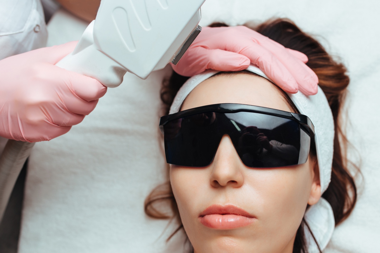 Laser facial treatment with a vascular laser